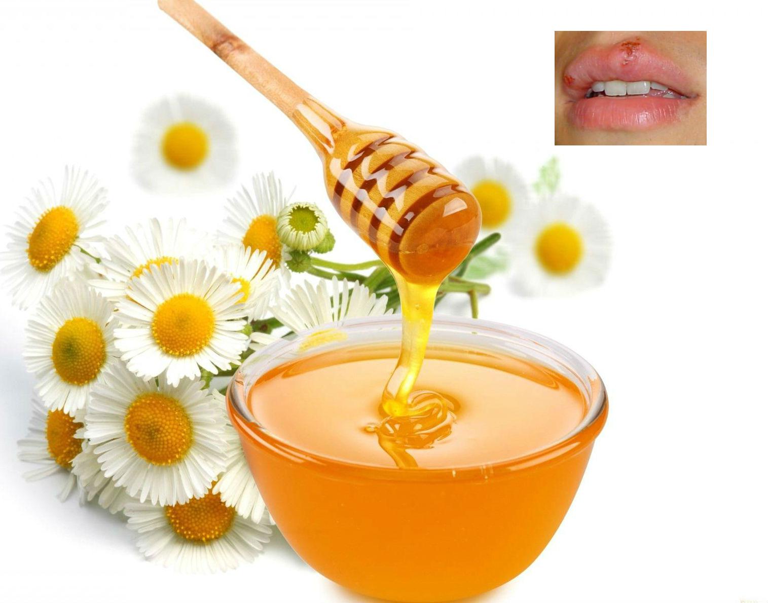 Супер ефективна рецепта с мед помага при херпес
